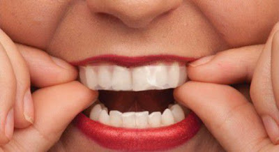 Tổng hợp các phương pháp tẩy trắng răng an toàn mới nhất 2016