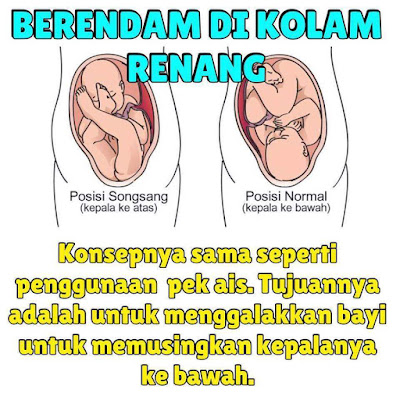 tips kehamilan, cara hindari kelahiran songsang, kelahiran songsang