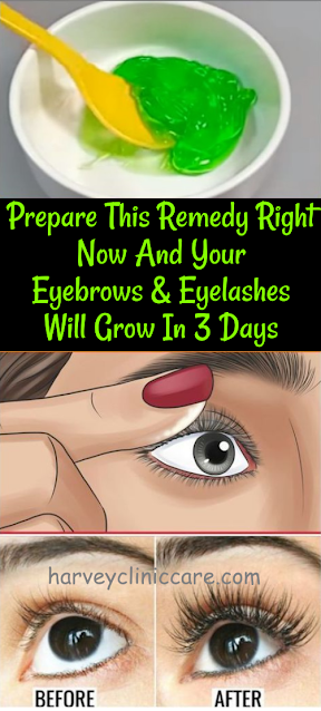 Prepare This Serum Right Now And Your Eyebrows And Eyelashes Will Grow In 3 Days