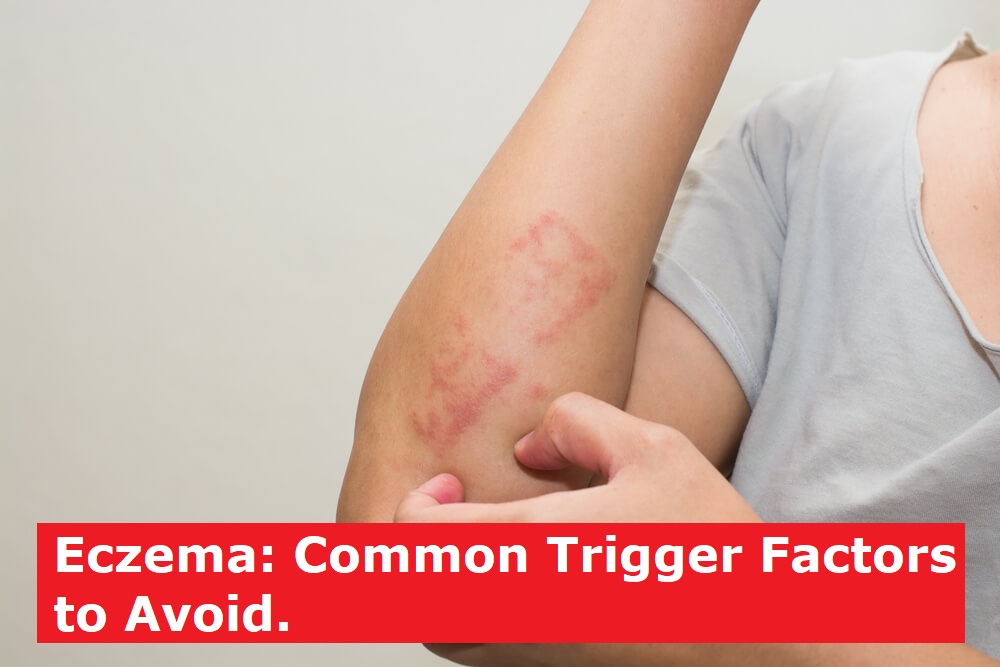 Eczema: Common Trigger Factors to Avoid.