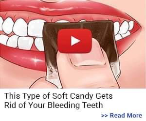 candy bleeding teeth