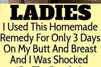 LADIES I USED THIS HOMEMADE REMEDY FOR ONLY 3 DAYS ON MY BUTT AND BREAST AND I WAS SHOCKED DUE TO THERESULTS!