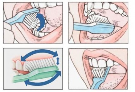 7 Cara Menghilangkan Bau Mulut