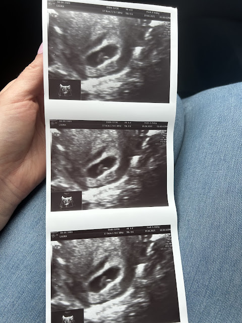 6 weeks pregnant