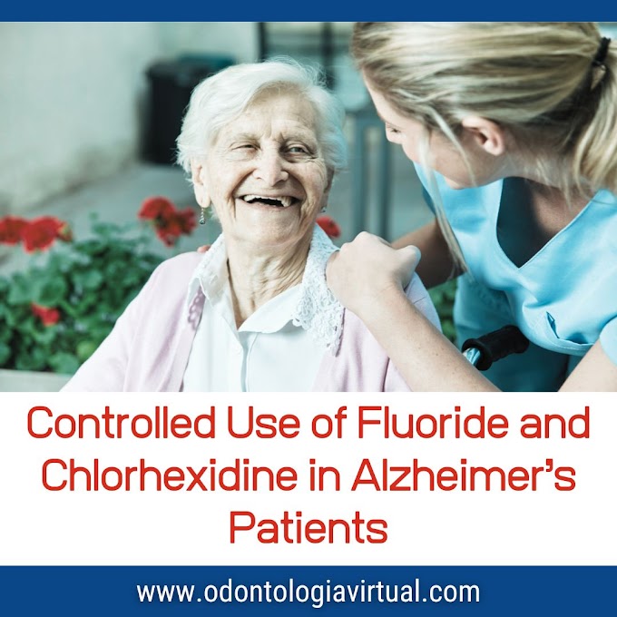 Controlled Use of Fluoride and Chlorhexidine in Alzheimer’s Patients: A Key Strategy for Caries Prevention and Biofilm Control