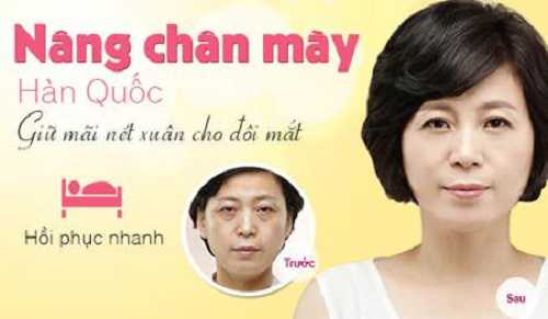 https://thammymat.com.vn/nang-treo-chan-may-hoi-xuan-cho-doi-mat/
