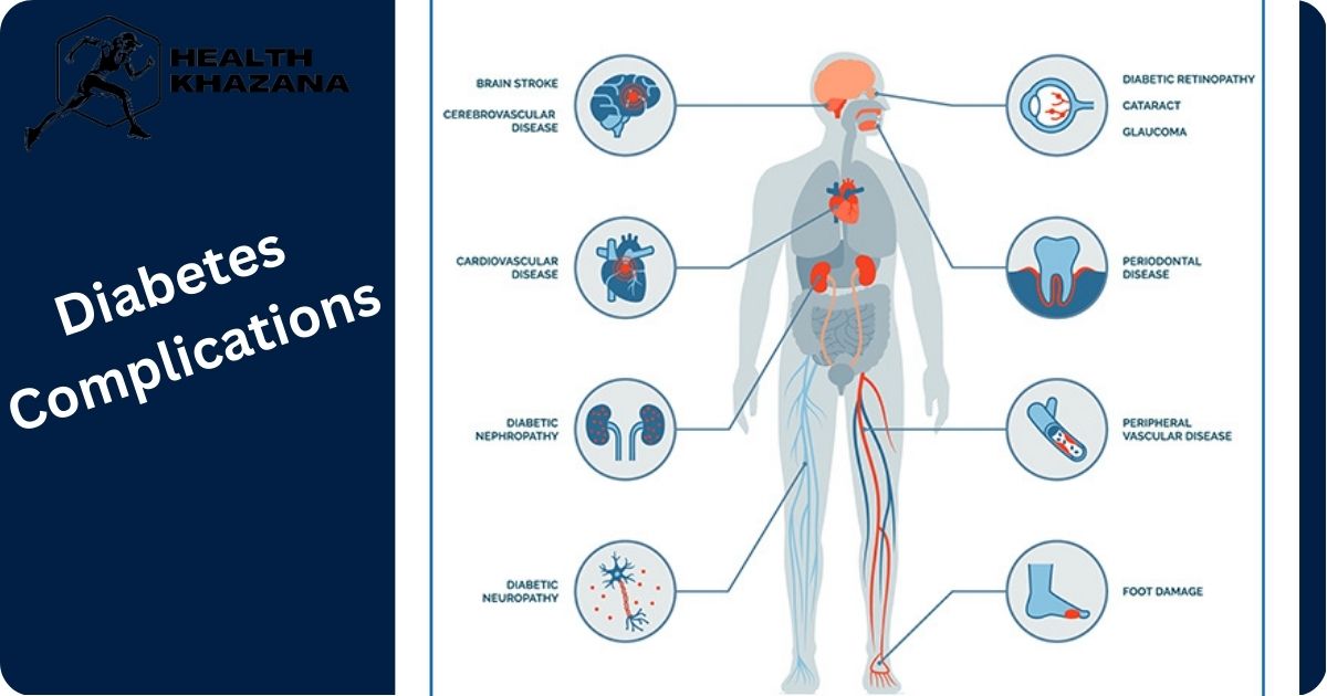 Diabetes (What is Diabetes) Symptoms, Complications, Causes, Treatment & Prevention