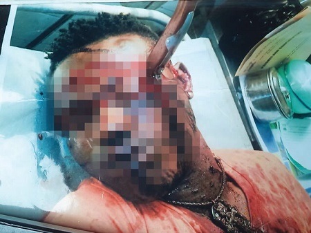 LAWMA Worker Brutally Stabbed in the Eye by Hoodlums for Tipping Off Police