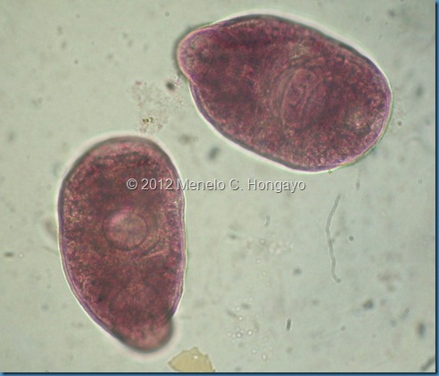 3 Fasciola cercaria