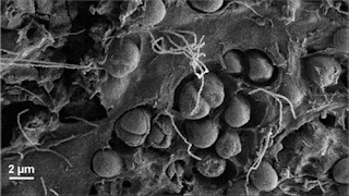 image: electron microscope view of the plastisphere