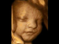 3d Ultrasound 29 Weeks5