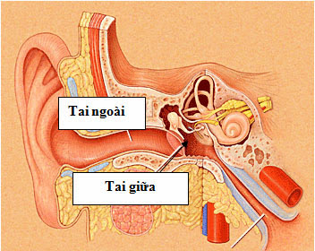 viêm tai giữa