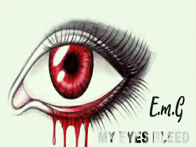  DOWNLOAD MUSIC - E.M.G - My Eyes Bleed