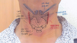   喉ニュース, 喉ニュース 赤飯, 喉ニュース ミックスボイス, 喉ニュース 輪状甲状筋, ボイスケアサロン 評判, ボイスケアサロン 口コミ, 會田茂樹, 會田茂樹 評判, ボイスケアサロン 2ch, ボイスケアサロン 感想, ボイスケアサロン ldp