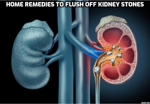 Kidney stones are hard, solid wastes that build up in the kidneys leading to crystal formation. There are four types such as calcium oxalate stones, struvite, uric acid, and crystalline stones. Amongst all most existing type and 80% of all stones are calcium oxalates. To treat this severe condition, here are best 8 home remedies to flush off kidney stones.