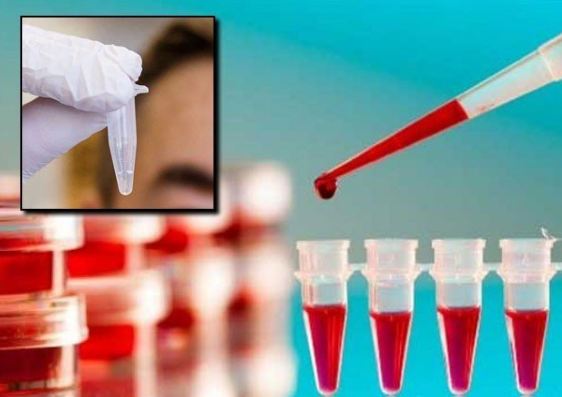 A Blood Test to Detect Depression was Invented