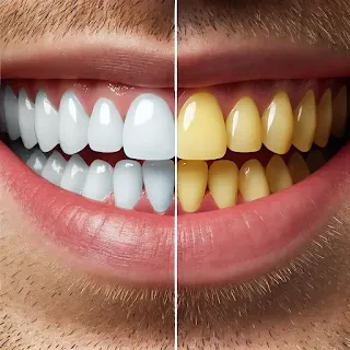 تبييض الأسنان بالثوم: طريقة طبيعية مذهلة لابتسامة ناصعة خلال أيام!