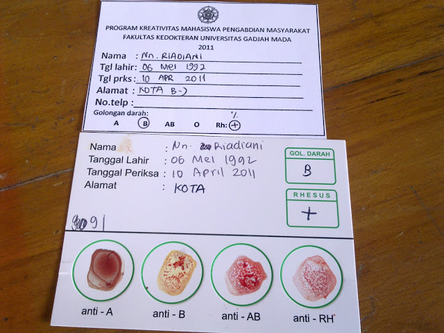 GOLONGAN DARAH B HARUS TAHU INI...!!! Cuma Golongan Darah B yang Punya 7 Keistimewaan Ini!