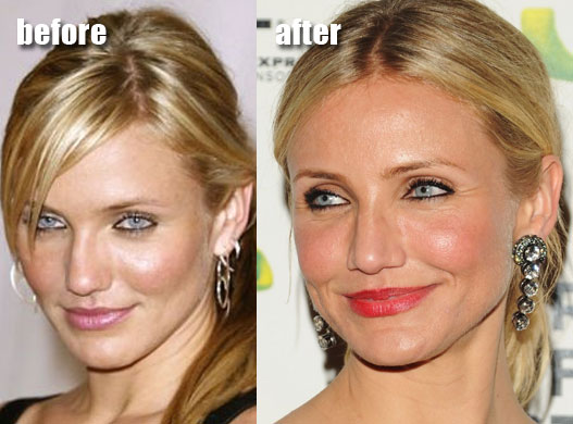 Cameron Diaz Before and After Plastic Surgery. Monday, May 10, 2010