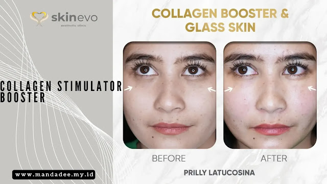 Collagen Stimulator Body