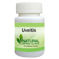 Herbal Products for Uveitis