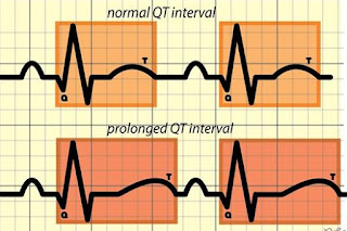 Prolonged QT interval