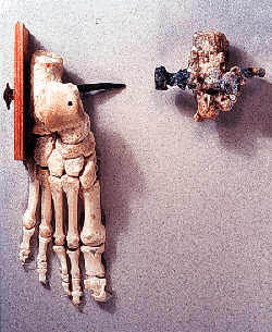 roman grave crucifixion victim