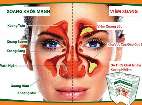 http://thaoduocdoctorninh.blogspot.com/