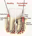 http://www.dental-clinic-delhi.com/gums-treatment.html