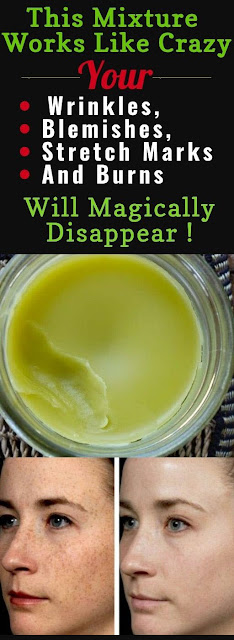 Prepare This Mixture Right Now And Your Wrinkles, Blemishes, Stretch Marks And Burns Will Disappear