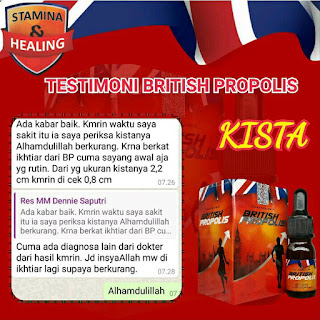 Cara Mengobati Kista Secara Alami Tanpa Operasi - 085862486502 [British Propolis Store]