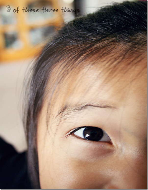 syd eyes 2