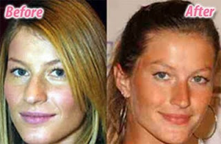 Female Celebrities pictures before and after plastic surgery