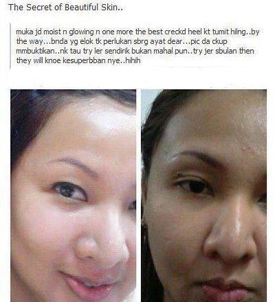 [GAMBAR][PROMOSI]TESTIMONI VITAMIN C 500MG (SARANAN PAKAR 