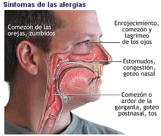 Congestion Nasal y sus sintomas