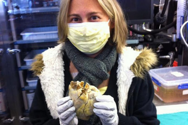 Penny holds her heart in her hands, which had to be replaced with a donor organ