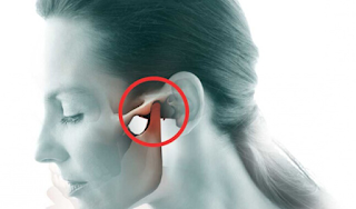 Fonoaudiologia na Disfunção Temporomandibular