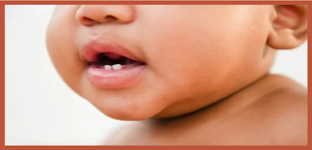 Anquiloglossia: por que a 'língua presa' pode ser perigosa para os bebês