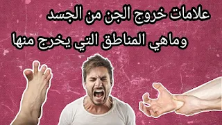 علامات خروج العارض من الجسم,علامات خروج العارض من الاجزاء العلوية من الجسد ,علامات خروج العارض من الراس ,اشارات خروج العارض من العينين,علامات خروج العوارض من الأنف,طرق خروج العوارض من الفم,علامات خروج العارض من أصابع اليدين,اشارات خروج العارض من البطن,اشارات خروج العوارض من الاجزاء السفلية من الجسد,هل تخرج العوارض من فتحة الشرج,علامات خروج العارض من  أصابع القدمين