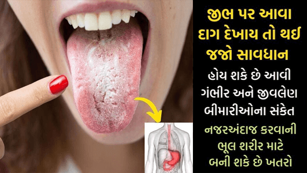 Such spots on the tongue are dangerous for the body