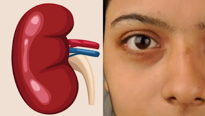 kidney kidney stone kidney stone symptoms kidney diagram kidney beans kidney failure symptoms pig kidney transplants kidney stones kidney function test apollo hospitals kidney racket chronic kidney disease kidney function function of kidney kidney stones in toilet kidney price in india legal kidney in hindi kidney stones symptoms kidney stone treatment real kidney kidney kharab hone ke lakshan symptoms of kidney stone kidney structure kidney price kidney infection structure of kidney kidney disease symptoms kidney infection symptoms kidney damage symptoms kidney disease kidney problem symptoms symptoms of kidney failure how to pass a kidney stone in 24 hours kidney stone pain area symptoms of kidney problem kidney failure kidney transplant kidney price in india kidney problems symptoms polycystic kidney disease calculus in kidney dual kidney transplant aiims kidney test name kidney position in body kidney stone pain kidney pain pig kidney transplantation what is the first sign of kidney problems kidney anatomy kidney transplant cost anatomy of kidney female body kidney location cortical cyst in kidney kidney location kidney dialysis kidney failure symptoms skin kidney in human body stone in kidney kidney cyst human kidney horseshoe kidney diagram of kidney real life kidney stones what size of kidney cyst is dangerous liv 52 side effects on kidney kidney location in human body kidney problems kidney specialist functions of kidney kidney in tamil normal kidney size kidney size cyst in kidney artificial kidney where is kidney located kidney test what are the first signs of kidney stones kidney picture location of kidney kidney stone pain relief internal structure of kidney what is kidney kidney function test name kidney cancer symptoms kidney stone symptoms in hindi kidney image kidney pain area kidney drawing kidney stone medicine acute kidney injury kidney disease symptoms in females kidney beans in hindi kidney stones treatment kidney meaning in hindi kidney tray right kidney normal size in cm 7 day kidney stone diet chart kidney biopsy chronic kidney disease symptoms kidney images 4 methods for kidney stone removal