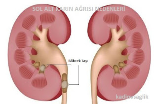 Sol Alt Karın Ağrısı Nedenleri