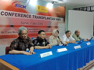 Perkembangan Transplantasi Hati di RSCM