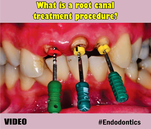 Endodontics