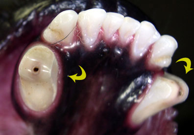 Black Hole On Tooth1