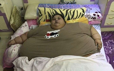 The death of the world's largest woman, weighing more than half a ton!
