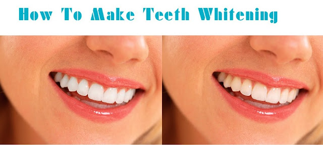 11 how to whiten teeth Faster and Naturally