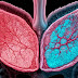 Sarcoidosis: | isufra 
