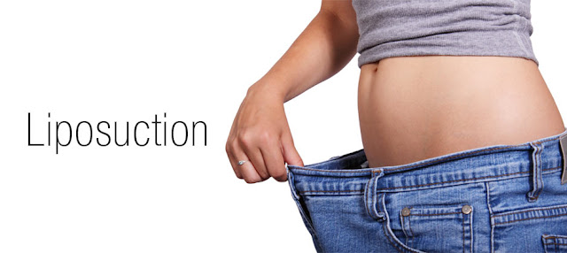 Liposuction in Hyderabad