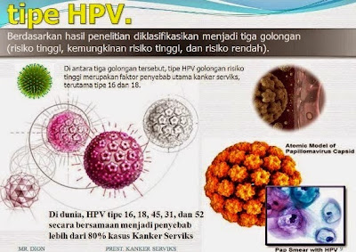 virus kutil kelamin